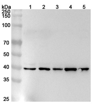 PSTPIP1 Rabbit Polyclonal Antibody