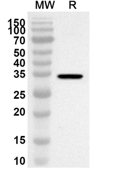 SYT7 Rabbit Polyclonal Antibody