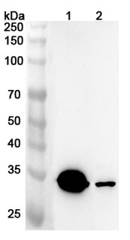 ACOT7 Rabbit Polyclonal Antibody