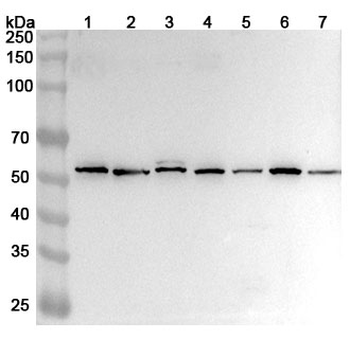 CD226/DNAM-1 Rabbit Polyclonal Antibody
