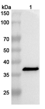Clostridium perfringens cpb/Beta-toxin Rabbit Polyclonal Antibody