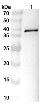 EEEV Spike glycoprotein E2 Rabbit Polyclonal Antibody