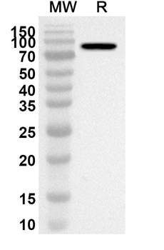 AKAP8 Rabbit Polyclonal Antibody