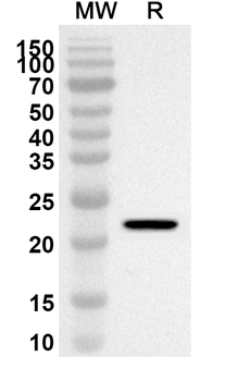 KRAS/K-Ras 2 Rabbit Polyclonal Antibody