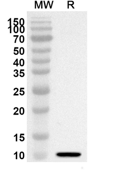 CLU Rabbit Polyclonal Antibody