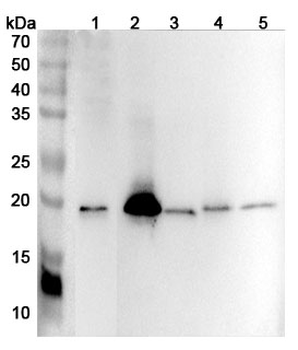 BID Rabbit Polyclonal Antibody