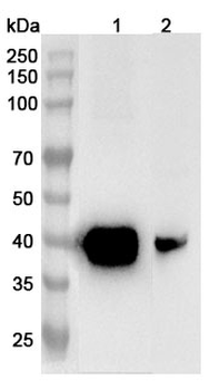 ASGR1 Rabbit Polyclonal Antibody