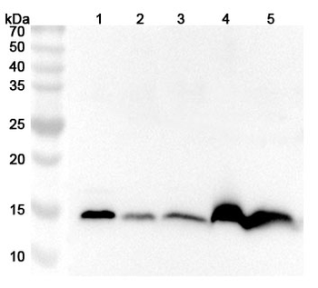 FABP4 Rabbit Polyclonal Antibody