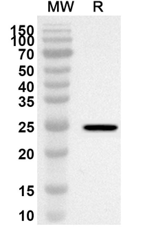 TARM1 Rabbit Polyclonal Antibody