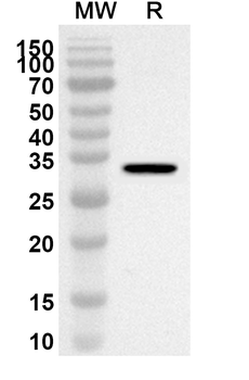 RELA Rabbit Polyclonal Antibody