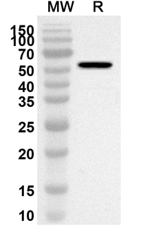 TPH1 Rabbit Polyclonal Antibody