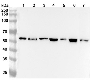 FGB/Fibrinogen beta Rabbit Polyclonal Antibody