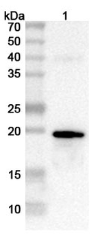 Pseudomonas aeruginosa PcrV Rabbit Polyclonal Antibody