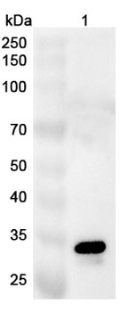 PSA/KLK3 Rabbit Polyclonal Antibody