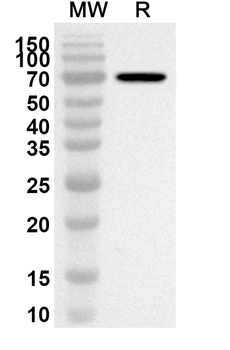 EV71 Protease 3C Rabbit Polyclonal Antibody