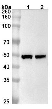 MBD2 Rabbit Polyclonal Antibody