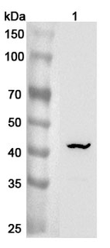 ST6GALNAC2/SIAT7-B Rabbit Polyclonal Antibody