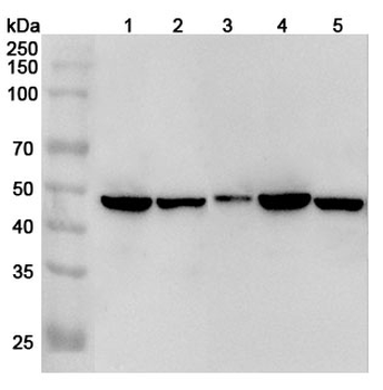 IL1RL1/ST2 Rabbit Polyclonal Antibody