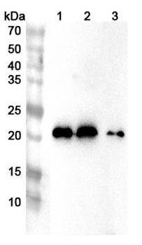 LCN2 Rabbit Polyclonal Antibody