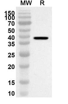 CD7 Rabbit Polyclonal Antibody