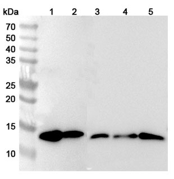 Gal1/LGALS1 Rabbit Polyclonal Antibody