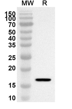 SLC27A3/FATP3 Rabbit Polyclonal Antibody