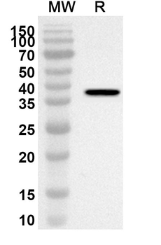 AATF Rabbit Polyclonal Antibody