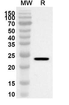 ADAM28 Rabbit Polyclonal Antibody