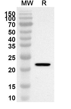 FRS2 Rabbit Polyclonal Antibody