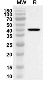 ACVR1 Rabbit Polyclonal Antibody