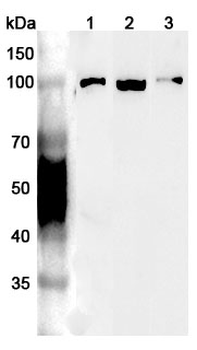 VCP Rabbit Polyclonal Antibody