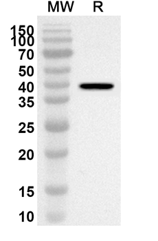 TGFBR2/TGFR-2 Rabbit Polyclonal Antibody