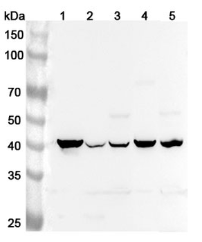 TACR2 Rabbit Polyclonal Antibody