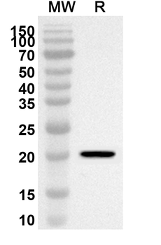 ATF6 Rabbit Polyclonal Antibody