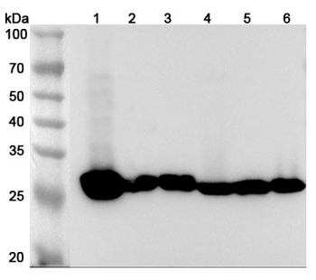 CA3/Carbonic anhydrase 3 Rabbit Polyclonal Antibody