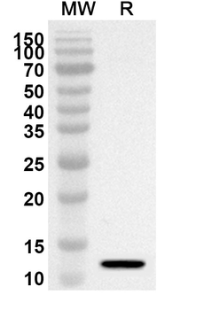 IGF1 Rabbit Polyclonal Antibody