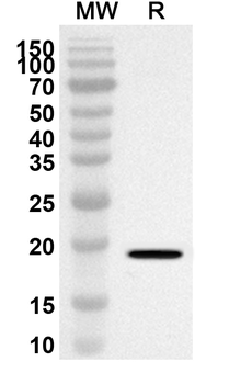 CDS2 Rabbit Polyclonal Antibody