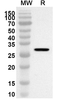SLIT3 Rabbit Polyclonal Antibody