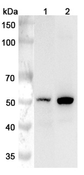 CYP11A1 Rabbit Polyclonal Antibody