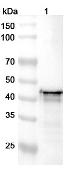 Clostridioides difficile Toxin B/tcdB Rabbit Polyclonal Antibody