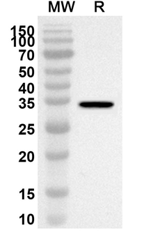 DDAH1 Rabbit Polyclonal Antibody