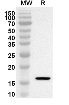 ADRA1A Rabbit Polyclonal Antibody