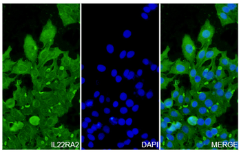 IL22RA2 Rabbit Polyclonal Antibody