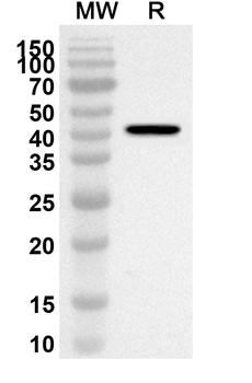 Clostridium perfringens plc/Phospholipase C/Alpha-toxin Rabbit Polyclonal Antibody