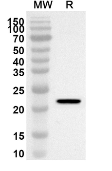 CPT1B Rabbit Polyclonal Antibody
