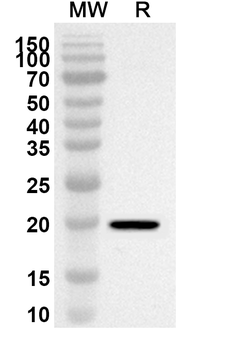 ATP5F1D Rabbit Polyclonal Antibody