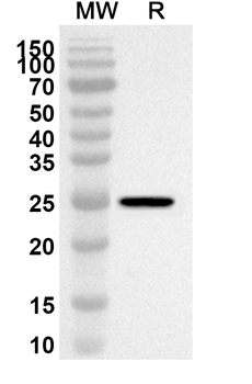 GUSB Rabbit Polyclonal Antibody