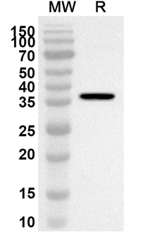 DBI Rabbit Polyclonal Antibody