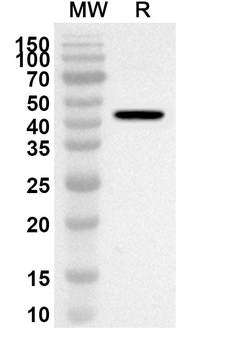 NDC80/HEC1 Rabbit Polyclonal Antibody