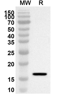 GDNF Rabbit Polyclonal Antibody